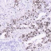 Abcam/艾博抗	ab16667	重组Anti-Ki67抗体[SP6]