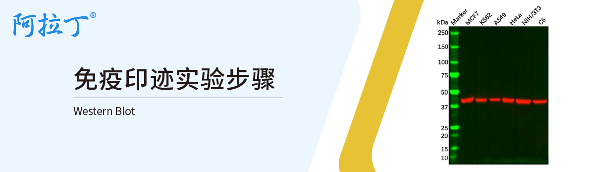 【阿拉丁】免疫印迹实验步骤（Western Blot）