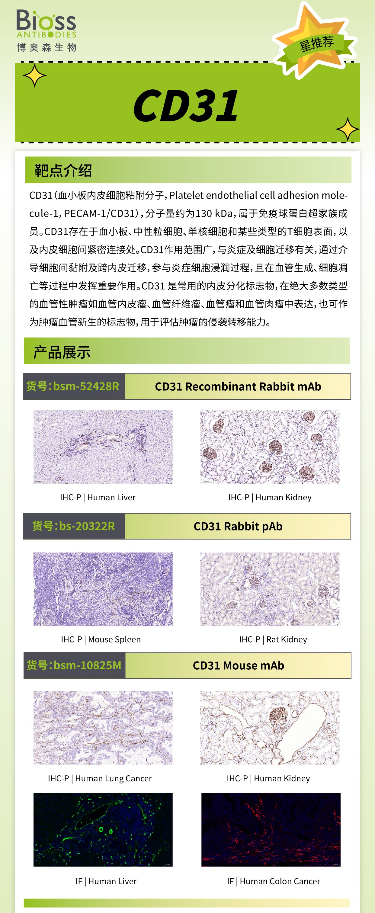 博奥森星推荐 | CD31 抗体
