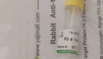 质粒载体实验原理及操作步骤