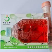 人脑星形胶质母细胞耐替莫唑胺细胞（U-87MG/tmz）