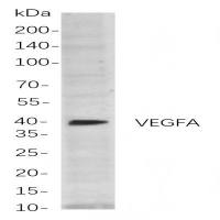 VEGF-A Rabbit mAb