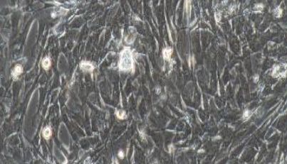 大鼠原代肛门内括约肌平滑肌细胞