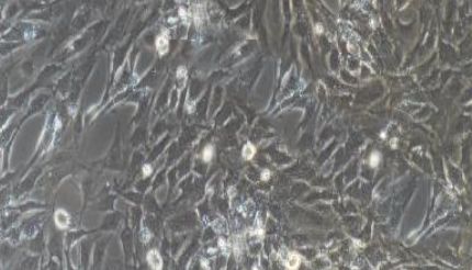 大鼠原代海绵体内皮细胞