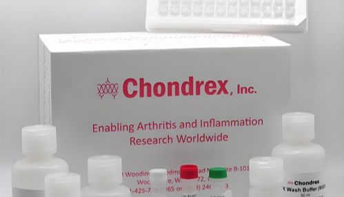 骨关节炎、关节损伤及衰老相关的软骨退变机制研究-小鼠蛋白聚糖检测试剂盒