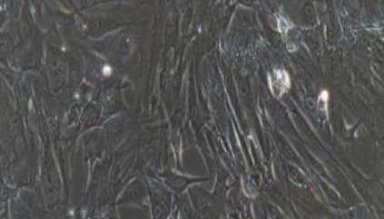 大鼠原代卵泡膜细胞