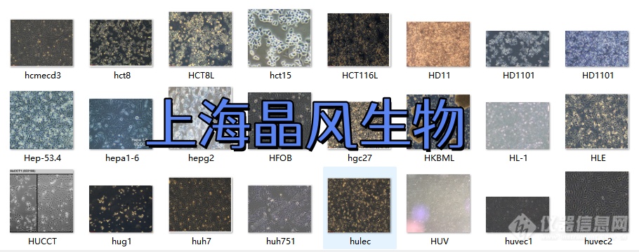 人大细胞癌细胞带荧光素酶LU99-LUC种子复苏