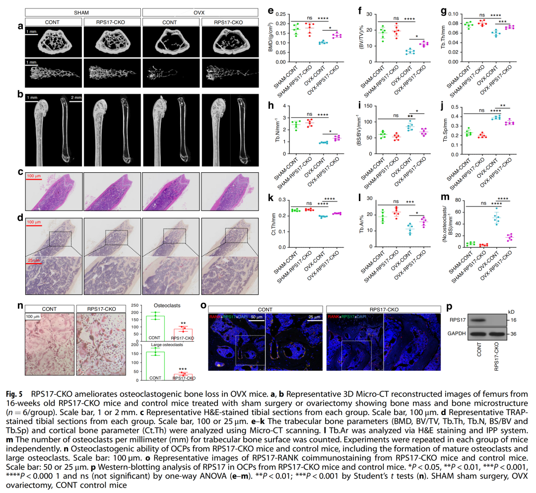 人外周破骨细胞前体发育模式