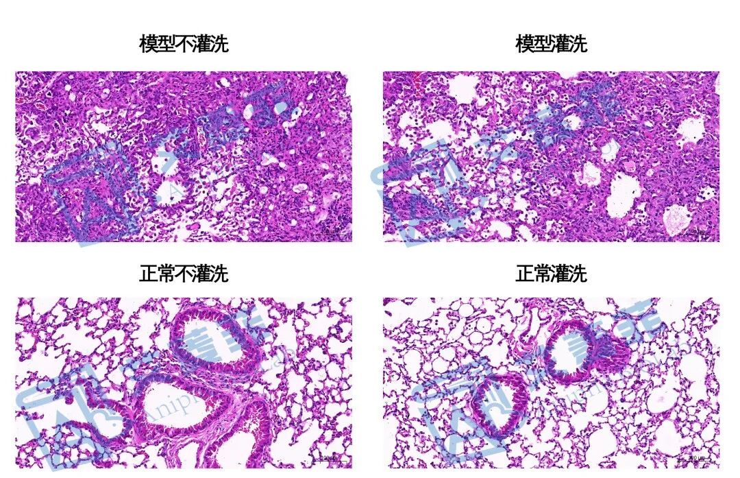 干货知识分享：肺泡灌洗液（BALF）灌洗后的肺组织会影响病理结构吗？