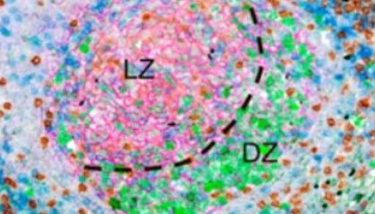强强联合| WTX+TMA破解淋巴瘤免疫逃逸之谜