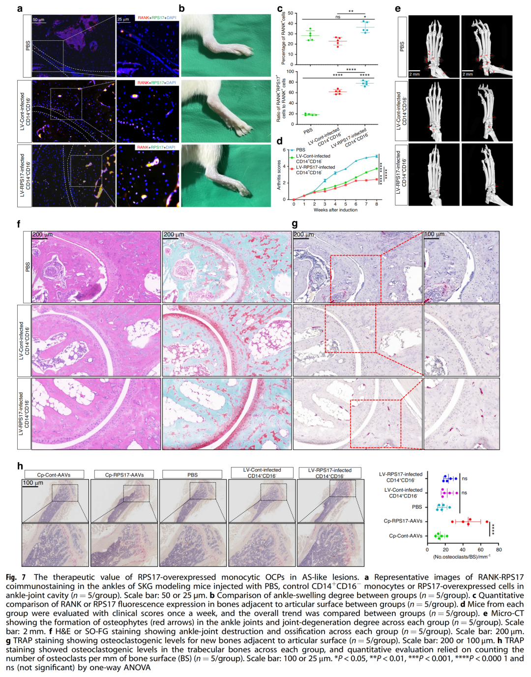 人外周破骨细胞前体发育模式