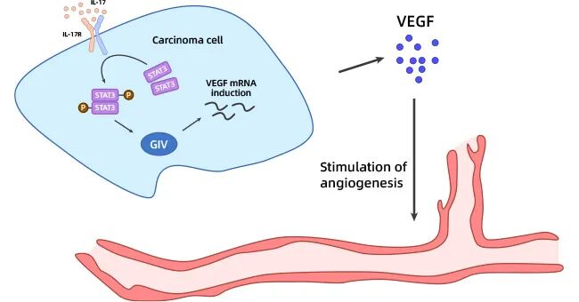 IL-17A在黑色素瘤中的作用机制