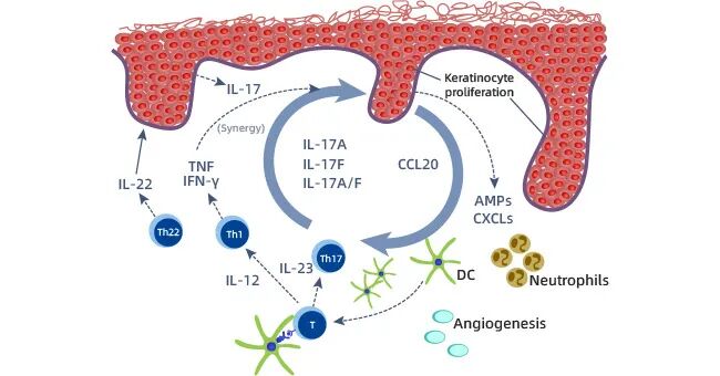IL-17A在银屑病中的作用机制