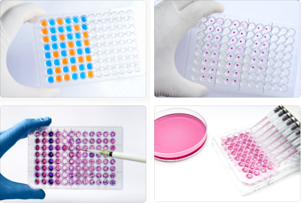鸭MHC ELISA检测中常见背景噪声来源有哪些