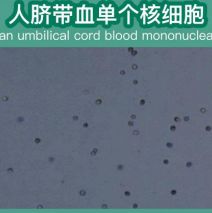 脐带血PRP前体分离服务