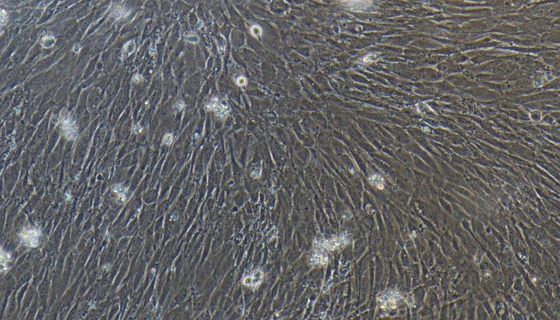 科研必看｜小鼠胰腺星状细胞原代分离，告别失败！实操攻略+避坑秘籍