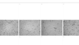 zenCELL owl 实时活细胞成像分析仪——长时间实时无损检测细胞活力