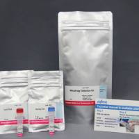 线粒体自噬—Mitophagy Detection Kit