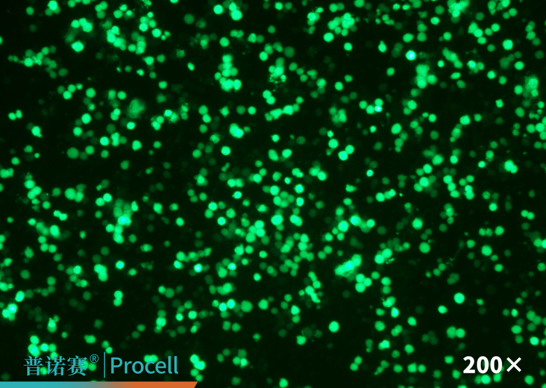 Mergene1000® THP-1细胞专用mRNA转染试剂荧光图片（EGFP）