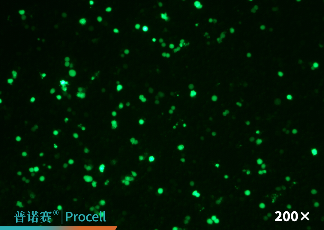 T品牌L3000转染试剂荧光图片（EGFP）