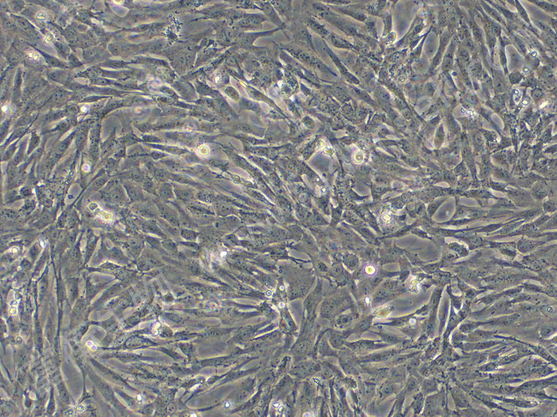 人心脏微血管内皮细胞-永生化；HCMEC(STR)