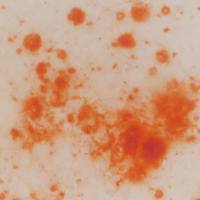 茜素红染色实验