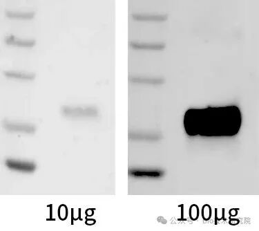 「WB急救室」之条带弱、无信号，蛋白样品的5大雷区，你踩过吗？
