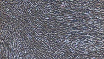 大鼠原代骨骼肌成纤维细胞