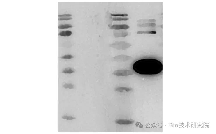 「WB急救室」之条带弱、无信号，二抗选错=白做！5大关键点，科研人速存