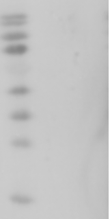 「WB急救室」抗体孵育全攻略：室温vs 4℃，你知道这些避坑小技巧吗？