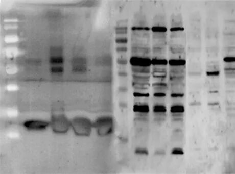 「WB急救室」聚焦高背景，告别“雾里看花”，教你一招解决它！