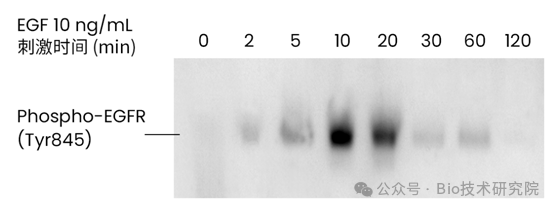 「WB急救室」从样品制备到结果分析，磷酸化蛋白WB全流程优化方案（值得收藏！）