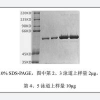 HPV 18-L1兔多克隆抗体