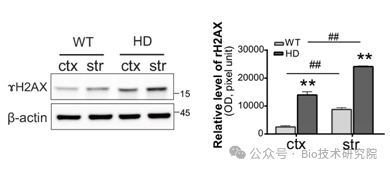 「WB急救室」文献中的WB实验图总是看不懂？这套“拆解法”建议收藏，10秒速判WB结果是否可信？