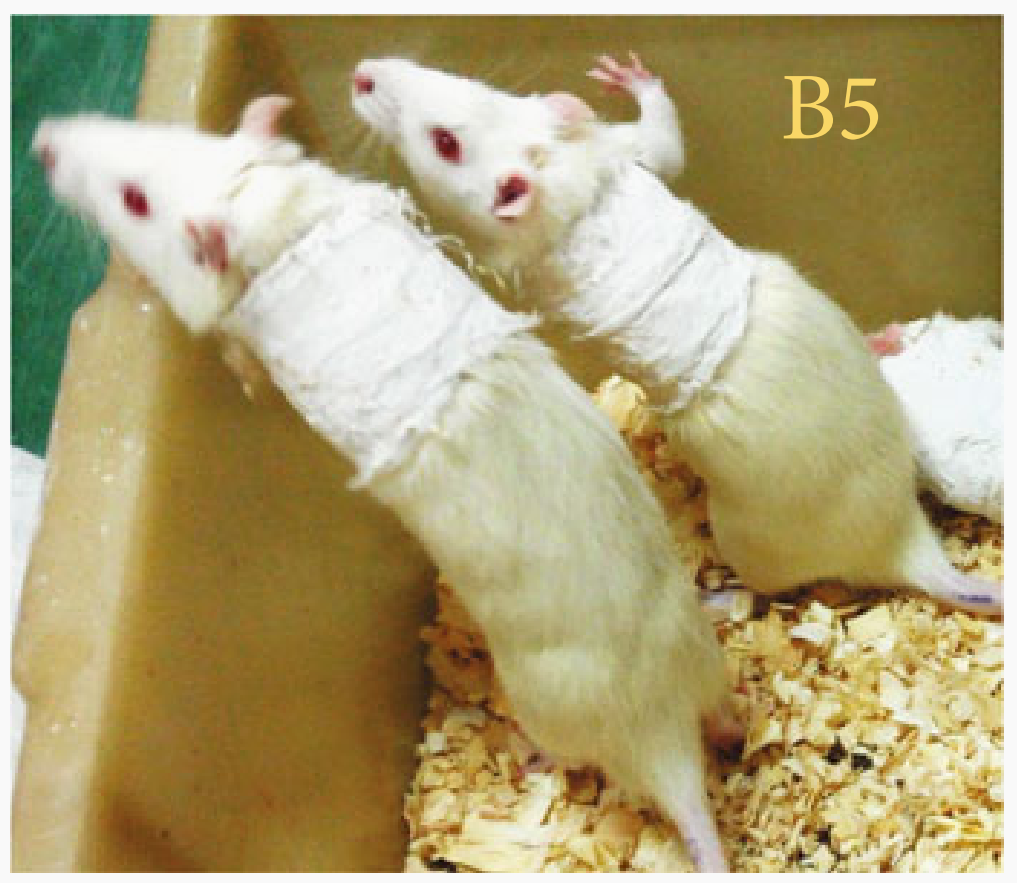 中风后康复新视角：揭秘CIMT疗法