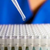 牛奶外泌体提取物 UR53202