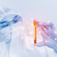 外泌体提取试剂盒(乳液) UR52146