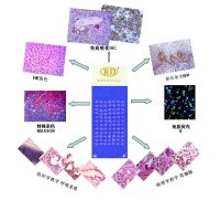 肺鳞癌40例对照40例组织芯片RTLSCN-20150480