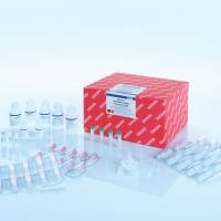 Qiagen货号80224核酸提取试剂盒AllPrep DNA/RNA/miRNA Universal Kit上海睿安生物19121878899