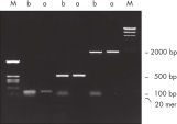 Complete primer removal after PCR.