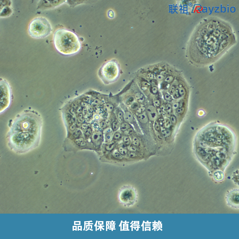 长期培养的杂交瘤细胞如何保持活力