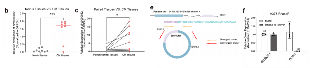 分子探针与表观遗传学研究好文分享：CircROR1通过结合 HNRNPL 调控FOXO4前体mRNA剪接，促进皮肤黑色素瘤转移，并通过负载RNAi的PEGLNPs作为治疗靶点