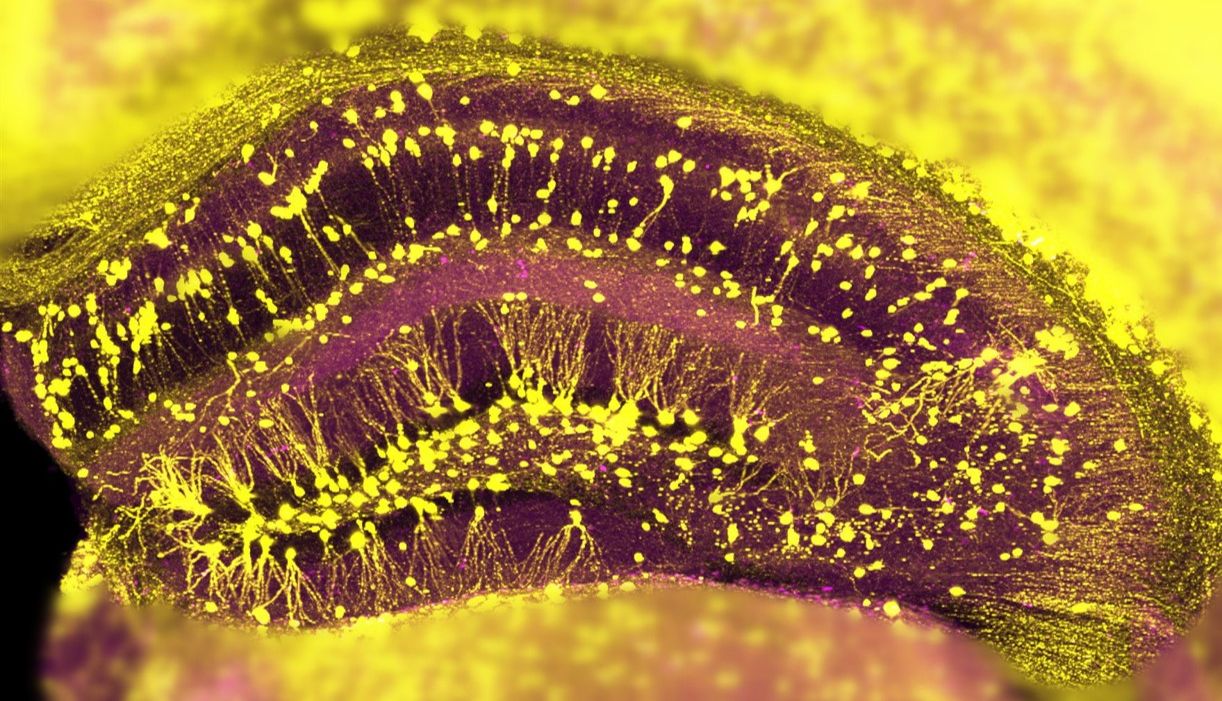 百会新知：显微成像技术破解脑科研究痛点
