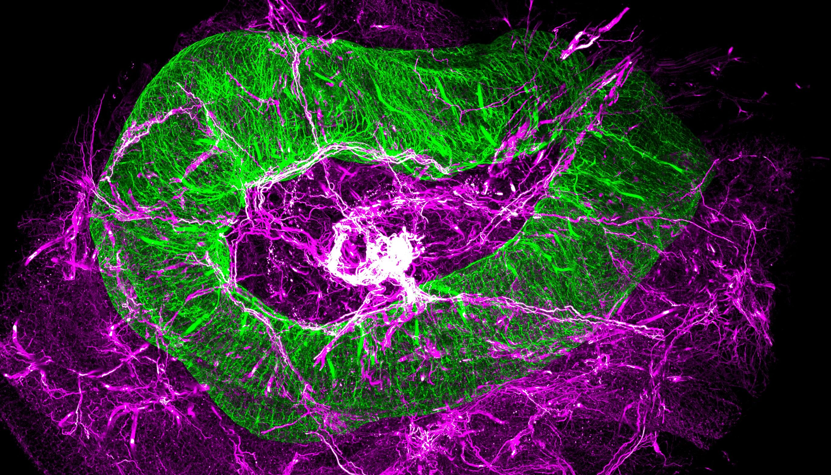 全球最快小鼠全身“高清CT”！单根神经纤维清晰可见