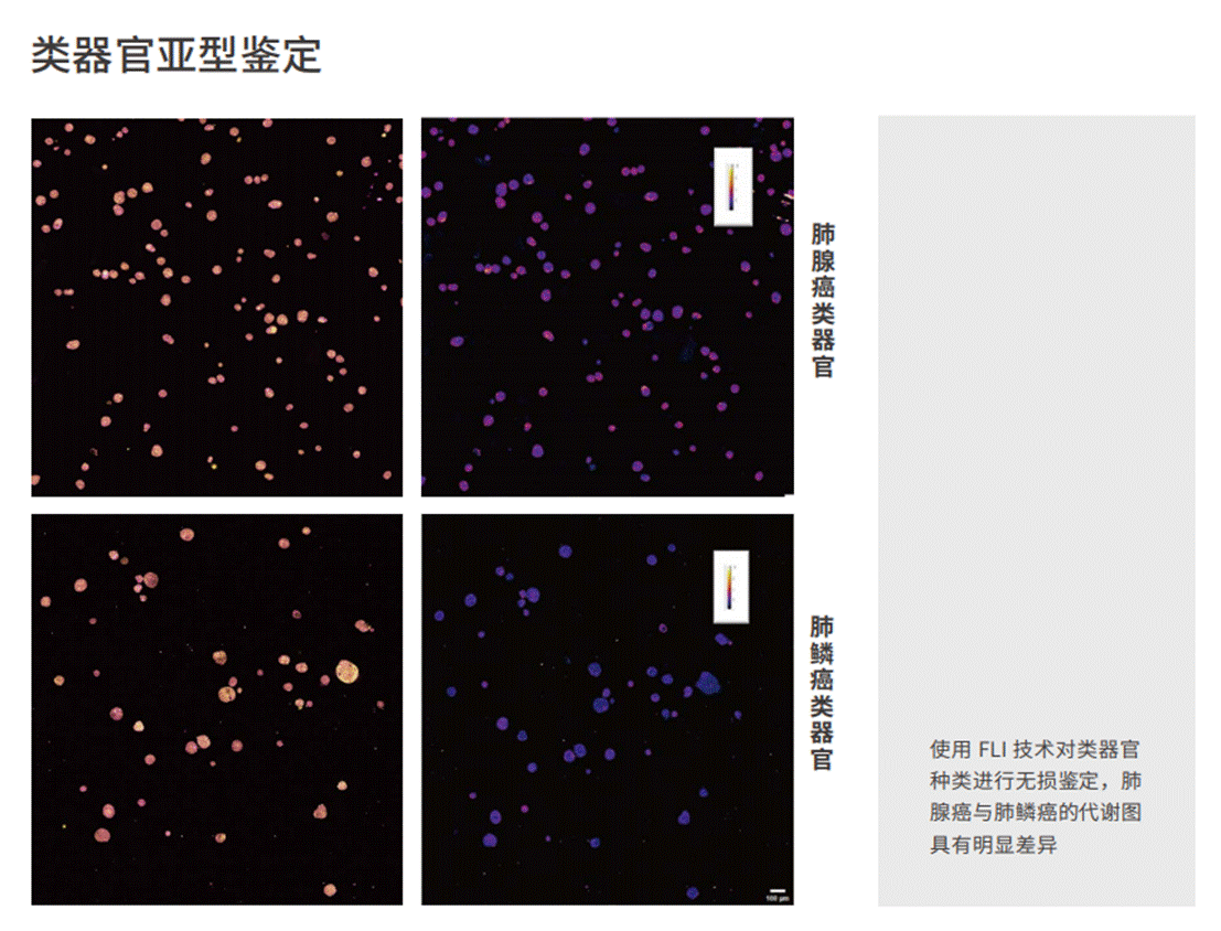应用6-类器官亚型鉴定-1