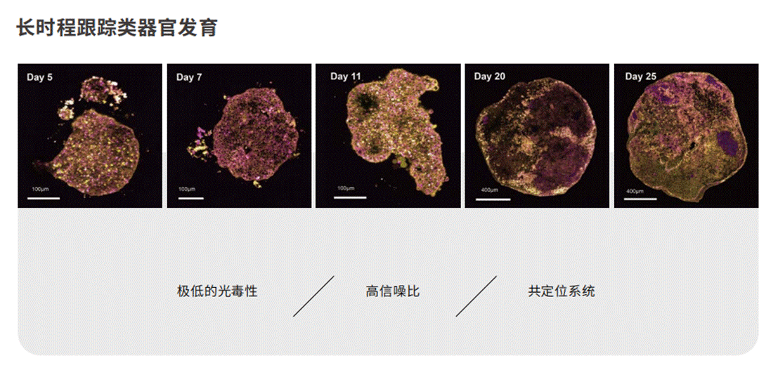 应用2-长时程跟踪类器官发育