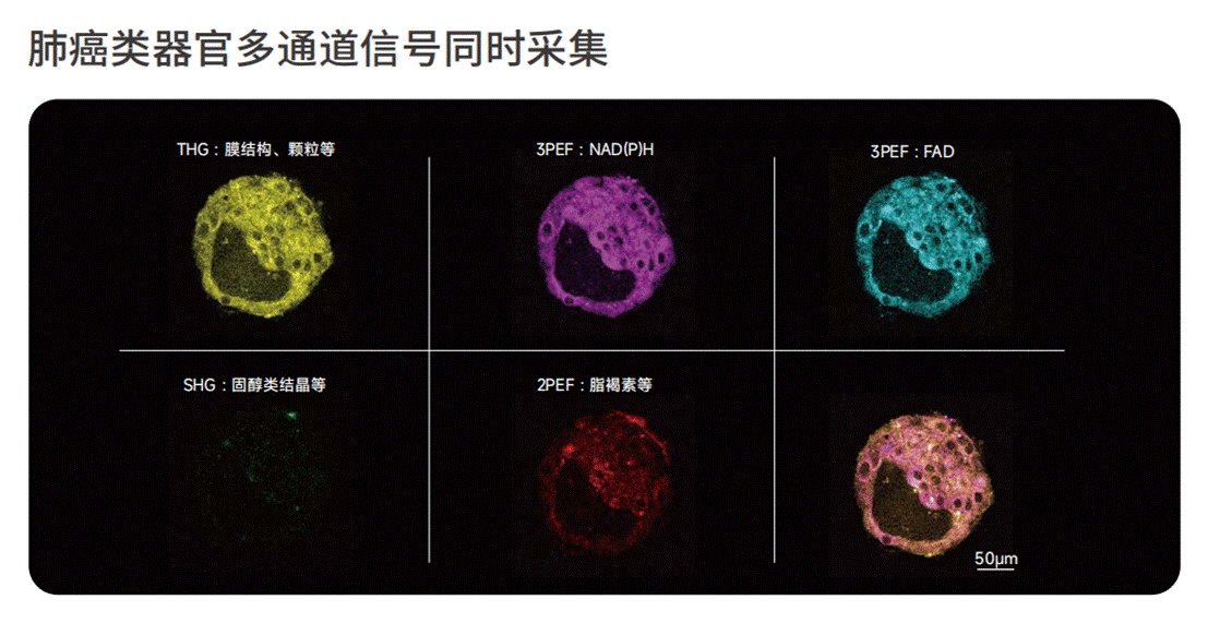 肺癌类器官多通道信号同时采集
