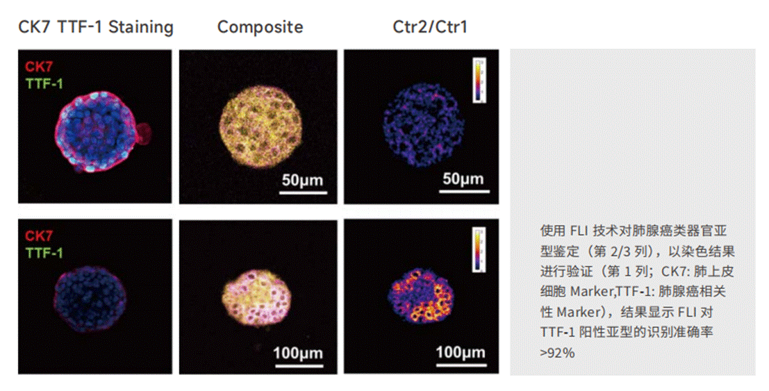 应用6-类器官亚型鉴定-2