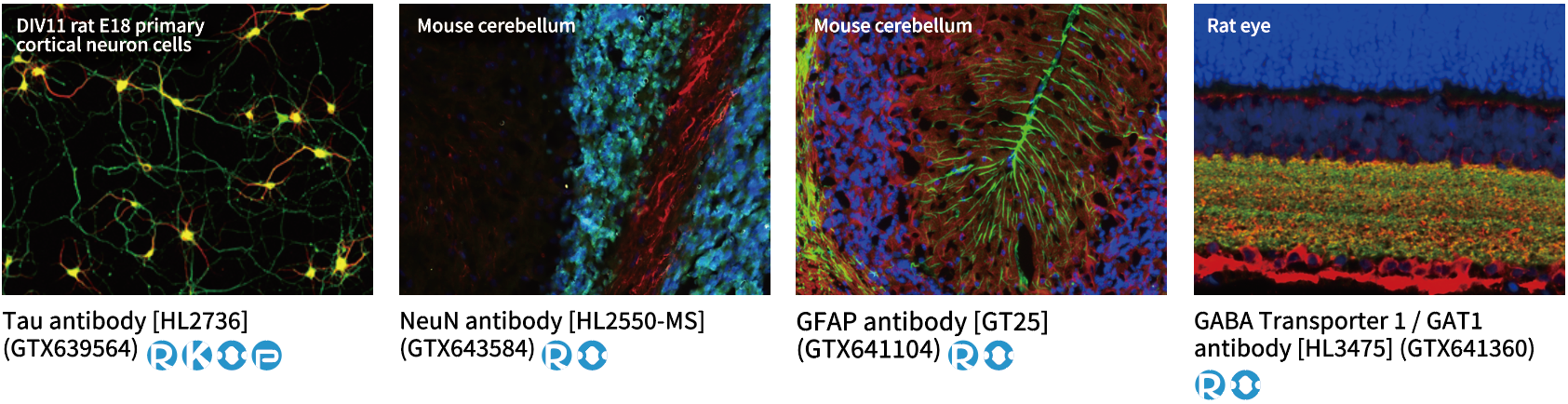 神经科研抗体 神经科研抗体