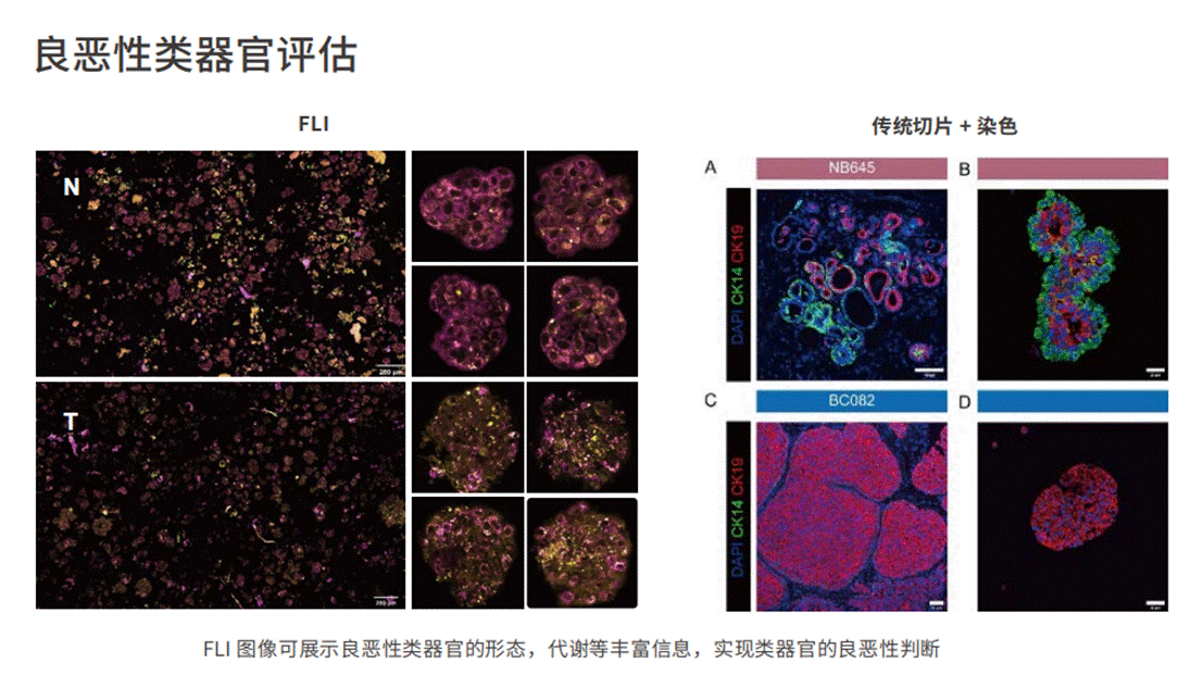 应用3-良恶性类器官评估